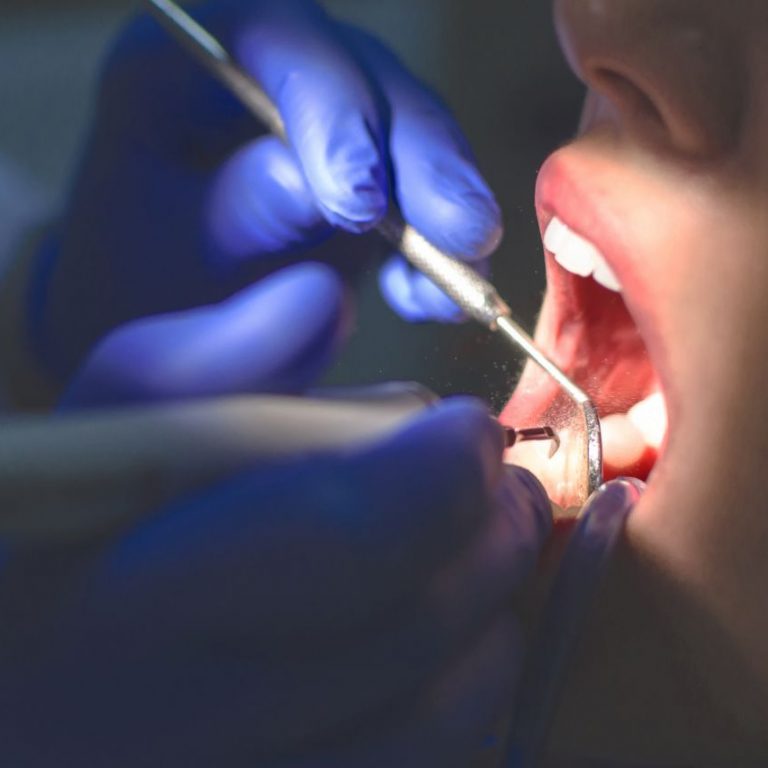 lanchares dental miedo dentista