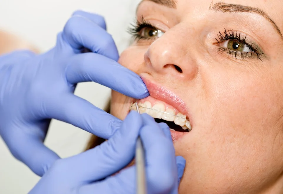 Ortodoncia con Brackets · Lanchares Dental